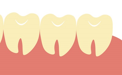 親知らず抜歯の痛みどんなもの？ピークは？痛みはいつまで？